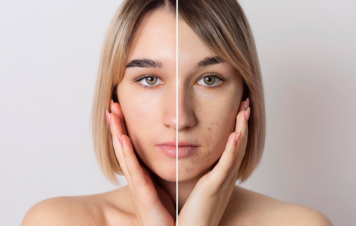 خواص ژل رویال برای پوست | بهترین کلاژن ساز طبیعی